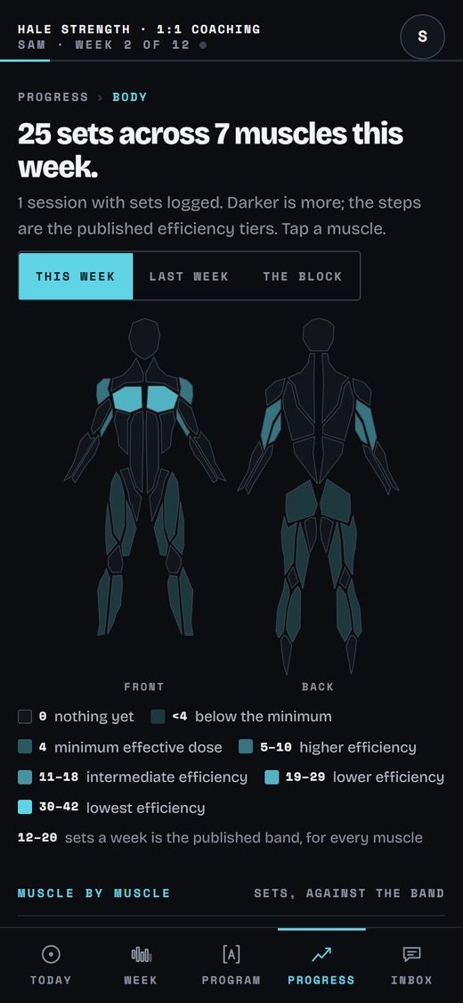 The body: The week's sets per muscle on a body map, against the published range.